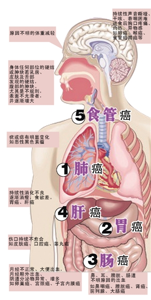 如何從體檢中揪出癌症的蛛絲馬跡